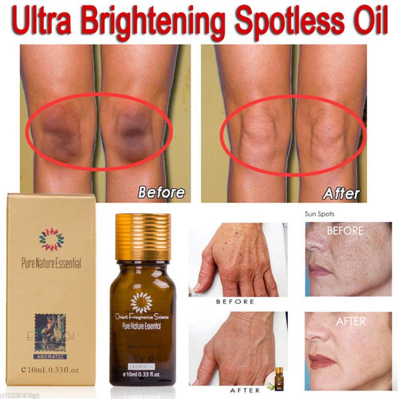Ultra Brightening Spotless Oil Pure Remove Ance Burn Strentch Marks Scar Removal Lavender Natural Essence Skin Care