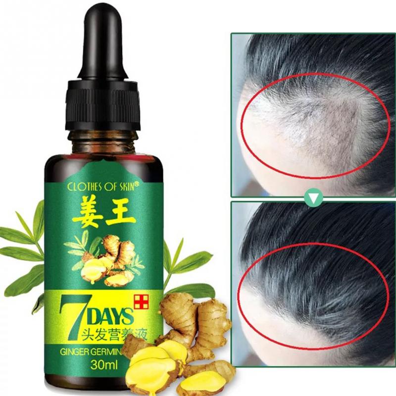 Hot Sales Unisex Anti Hair Loss Treatment Serum Ginger Extract Hair Regrowth Organic Beard Oil Growing Men Women Hair Care #719