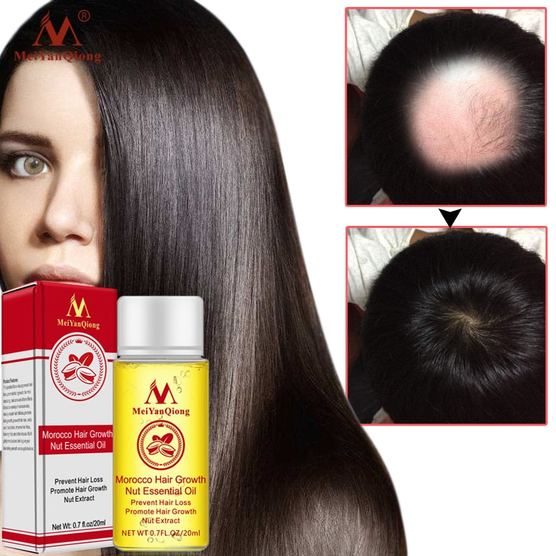 Fast Powerful Hair Growth Essence Hair Loss Products Essential Oil Liquid Treatment Preventing Hair Loss Hair Care Products 20ml